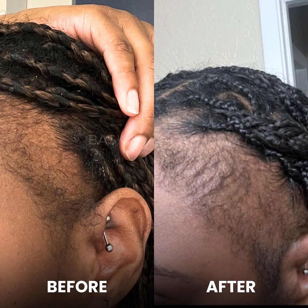 Scalp Health 101 - Tips for a healthy foundation - Bask and Lather Co