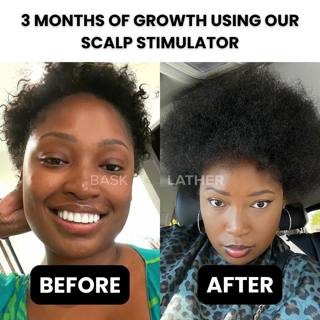 3 Rosemary Products Incorporate In Your Hair Care Routine - Bask and Lather Co