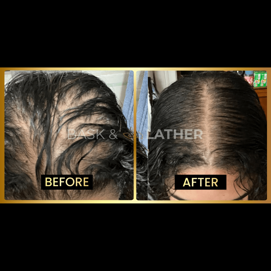 JUMBO Scalp Stimulator - Bask and Lather Co