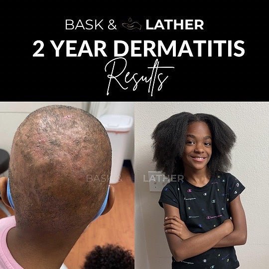 Nurture & Grow - Kids Healthy Hair Bundle - Bask and Lather Co