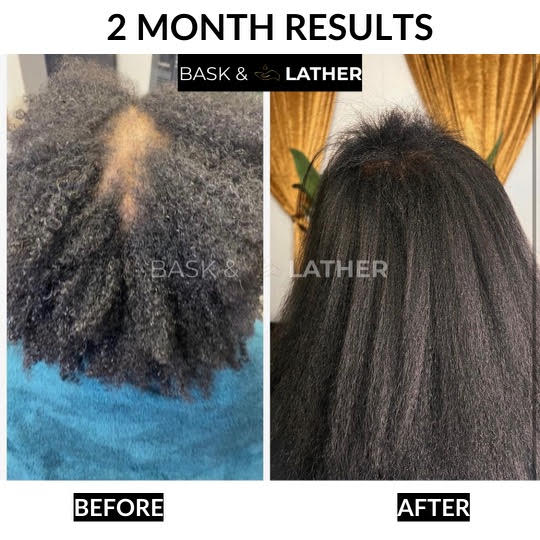 Healthy Hair Starter Kit - Limited Edition - Bask and Lather Co