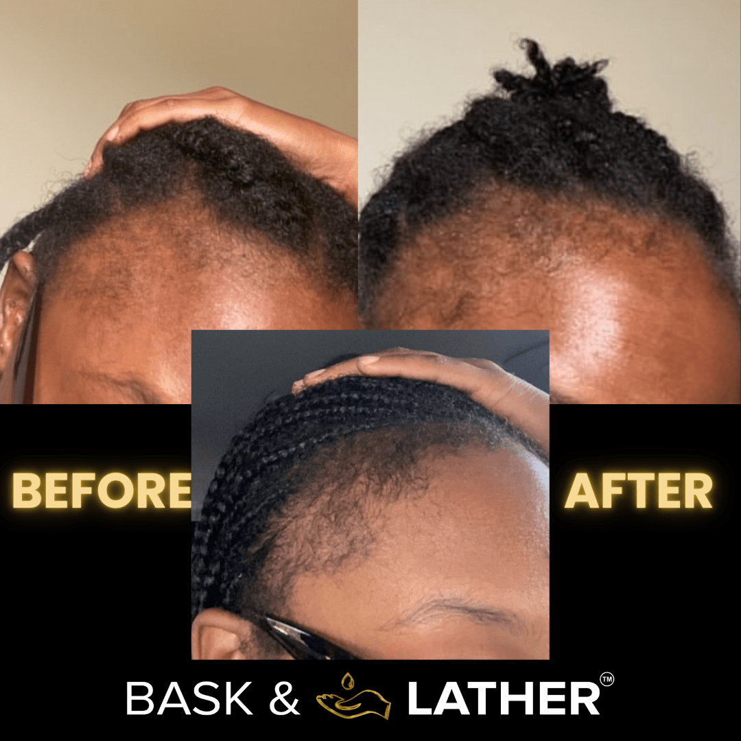 JUMBO Scalp Stimulator - Bask and Lather Co