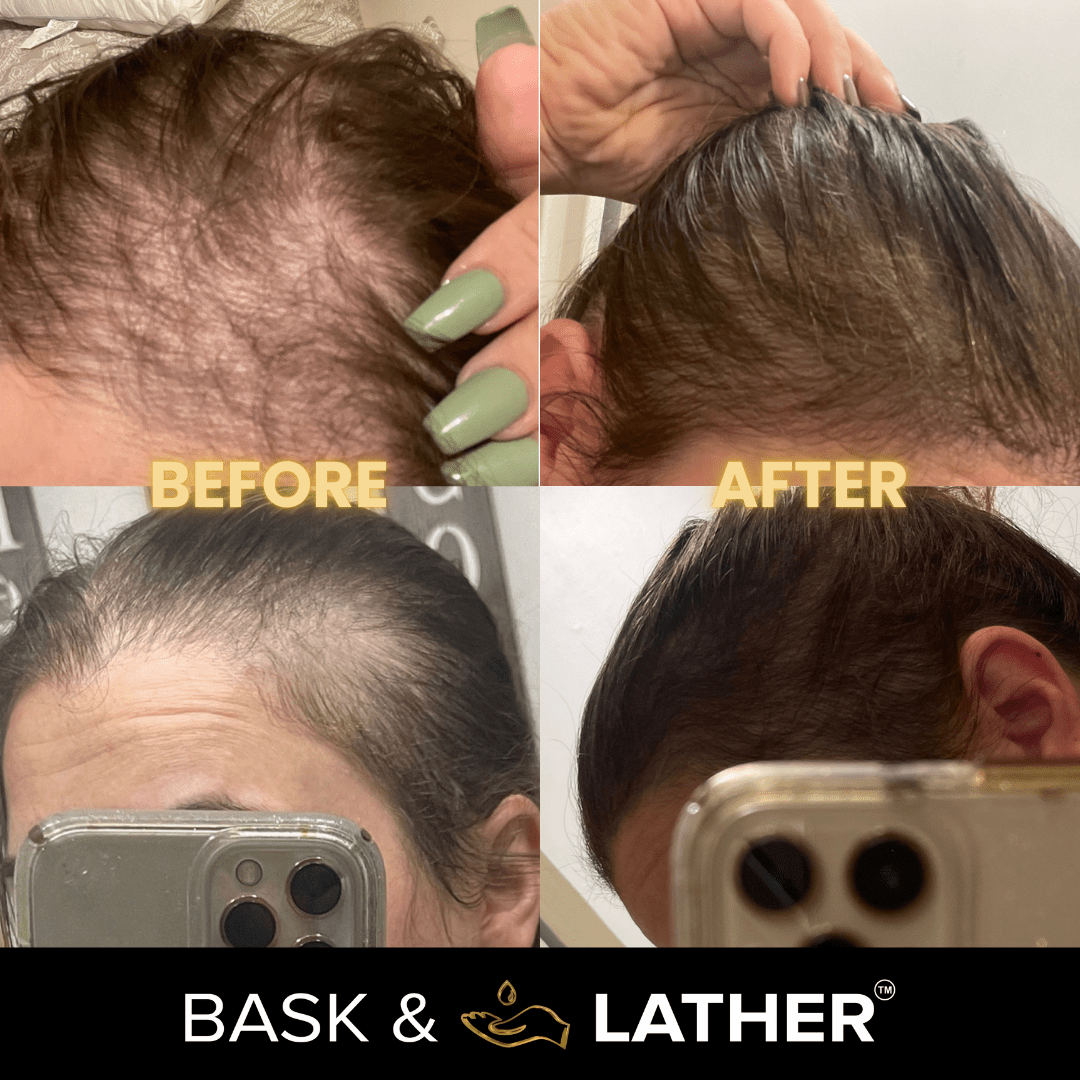 JUMBO Scalp Stimulator - Bask and Lather Co