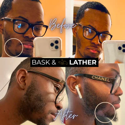 3 Products To Fix Your Patchy Beard
