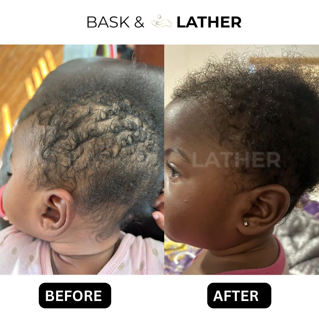How to Protect Your Baby’s Crown - Bask  and Lather Co