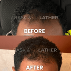Scalp Stimulator | Hair Growth Oil - Bask and Lather Co