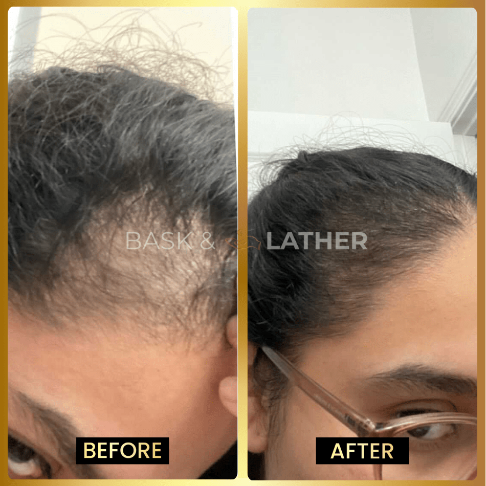 The Ultimate Growth Starter Set - Bask and Lather Co