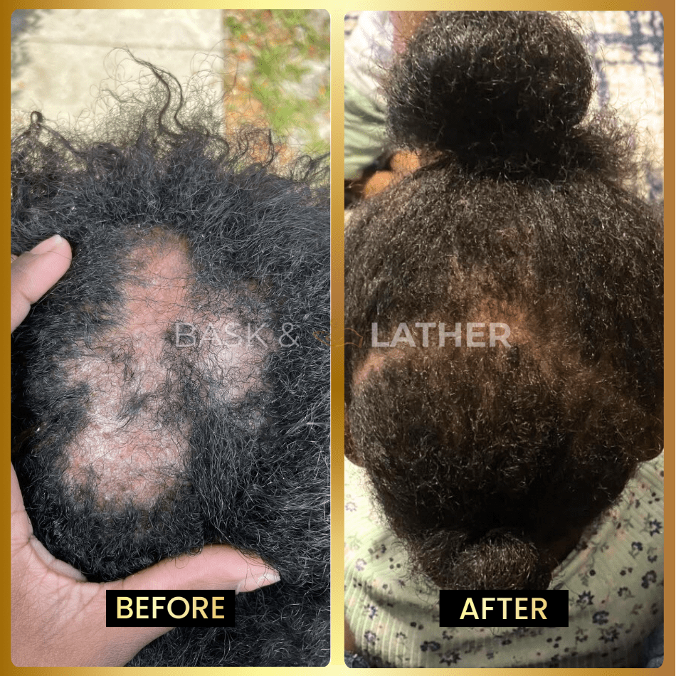 JUMBO Scalp Stimulator - Bask and Lather Co