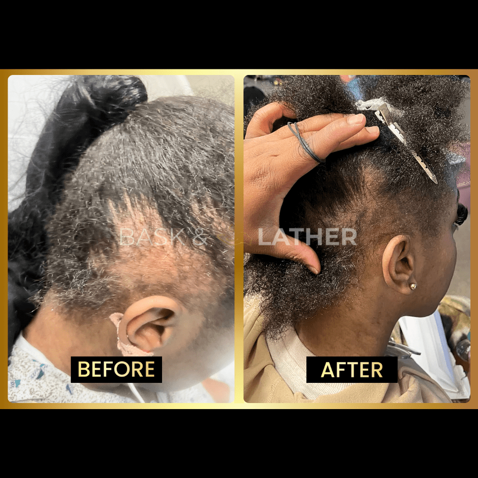 Scalp Stimulator & Hair Elixir | Growth & Length Retention Bundle - Bask and Lather Co