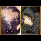 Scalp Stimulator - 3 Month Supply - Bask and Lather Co