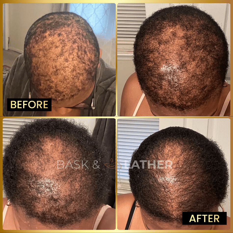 Men's Beard & Hair Growth Bundle - Bask and Lather Co