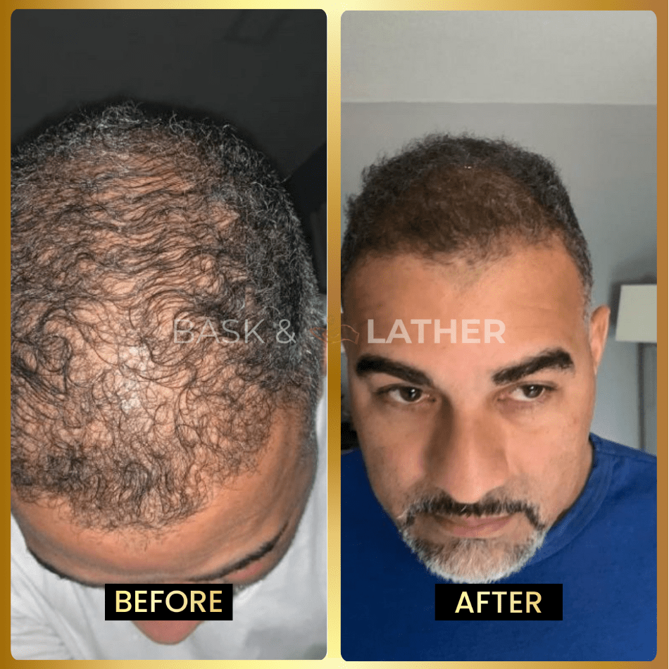 Men's Beard & Hair Growth Bundle - Bask and Lather Co