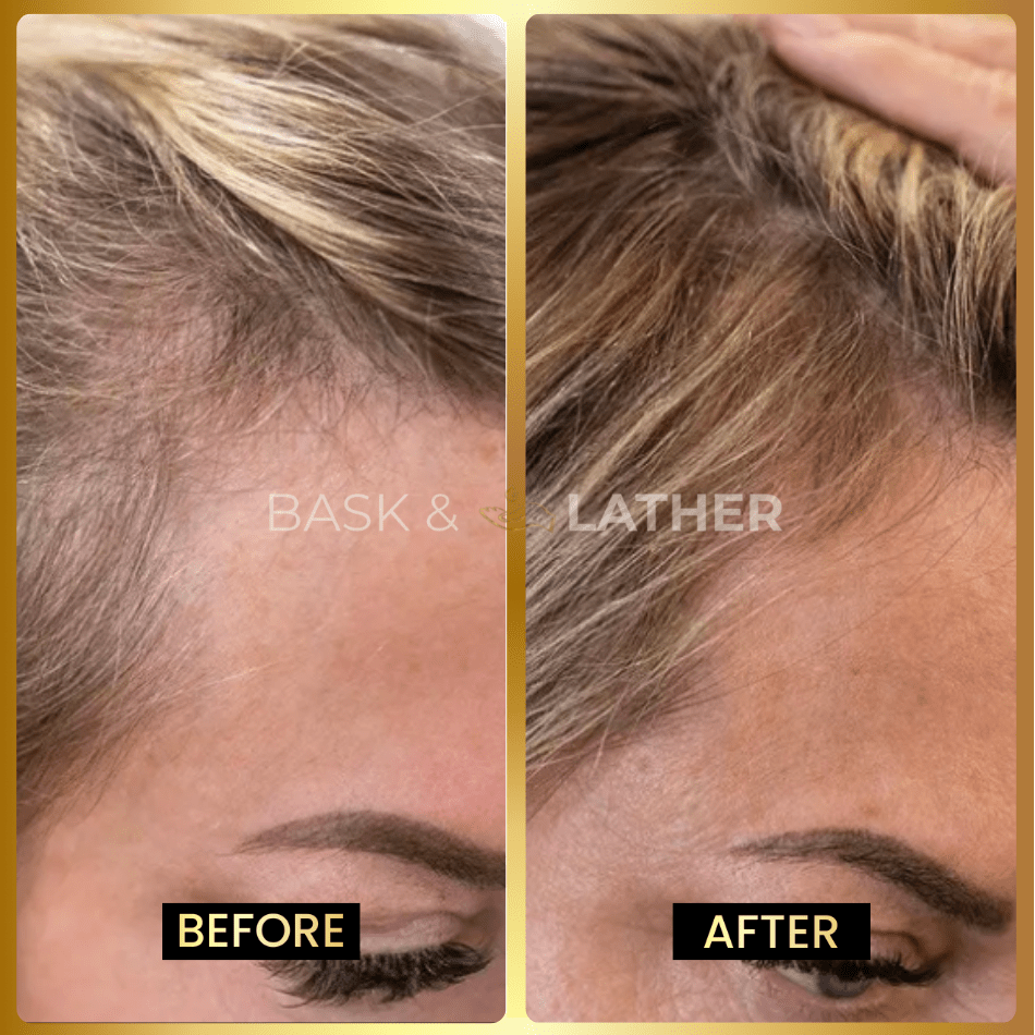 Scalp Stimulator & Hair Elixir | Growth & Length Retention Bundle - Bask and Lather Co