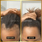 JUMBO Scalp Stimulator - Bask and Lather Co