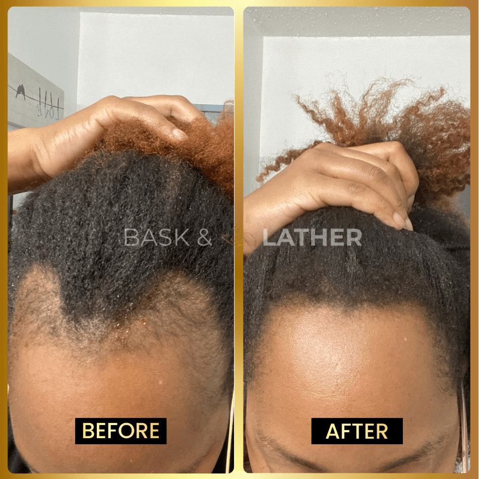 JUMBO Scalp Stimulator - Bask and Lather Co