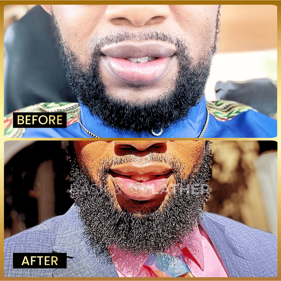 Beard Growth Oil (Hair Growth) - Bask and Lather Co