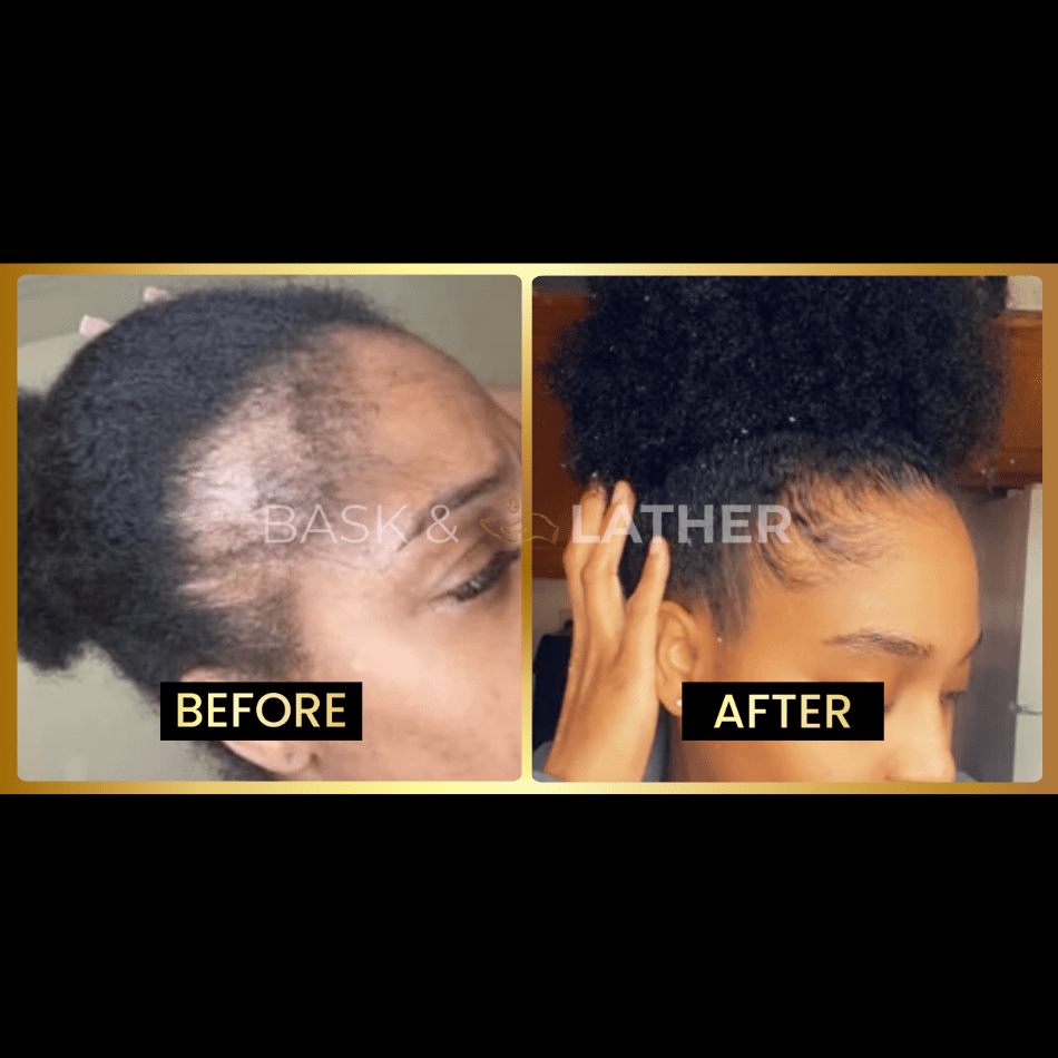 JUMBO Scalp Stimulator - Bask and Lather Co