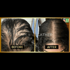 JUMBO Scalp Stimulator - Bask and Lather Co