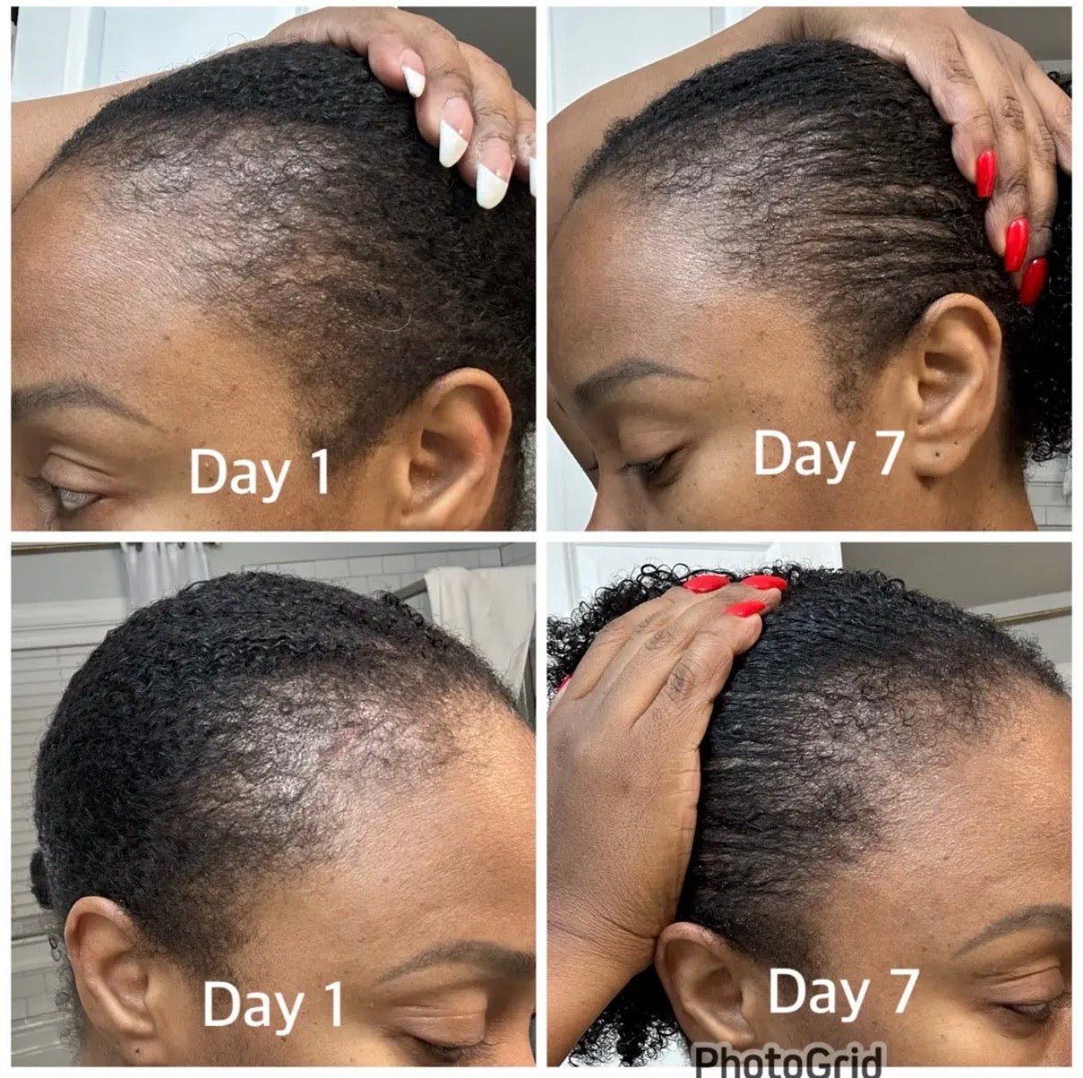 Jumbo Scalp Stimulator - Bask and Lather Co