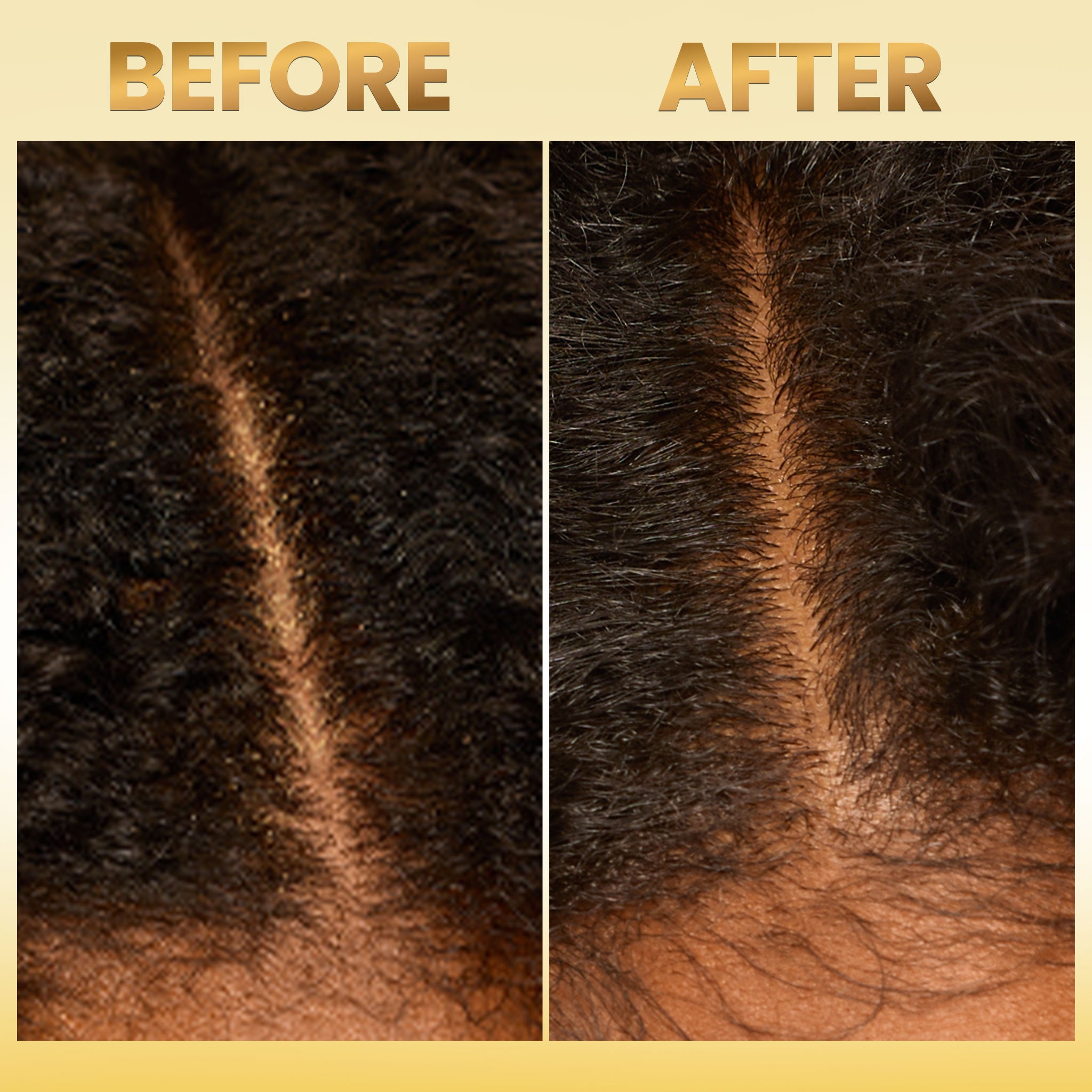 Scalp Balancing Shampoo - Bask and Lather Co