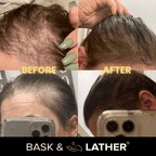 Jumbo Scalp Stimulator