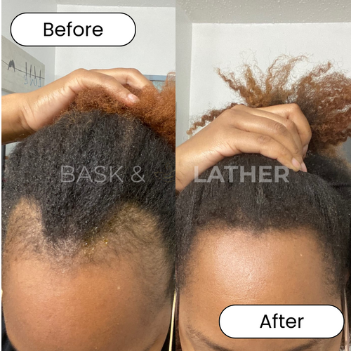 Thinning Result 1