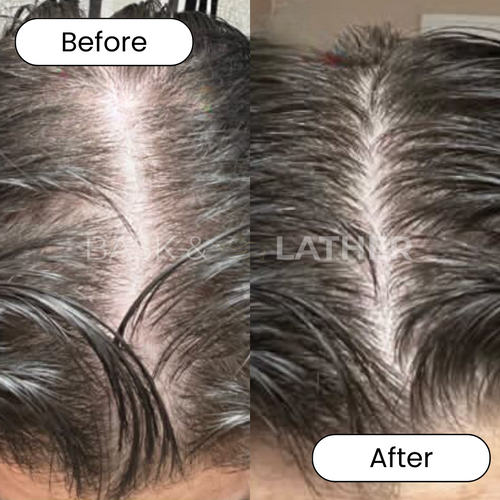 Thinning Result 2