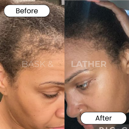 Thinning Result 4