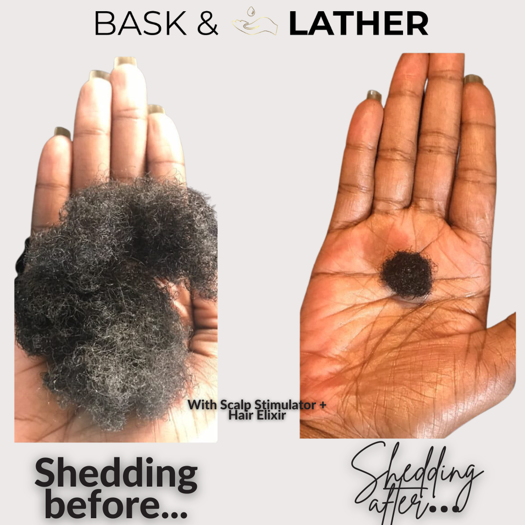 before and after the scalp stimulator and hair elixir