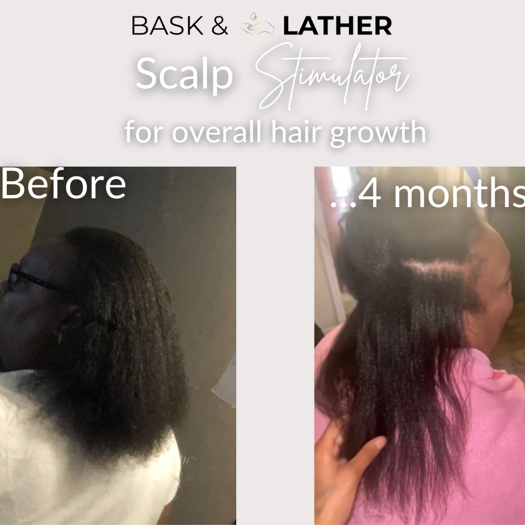 Before and after using the scalp stimulator - hair growth