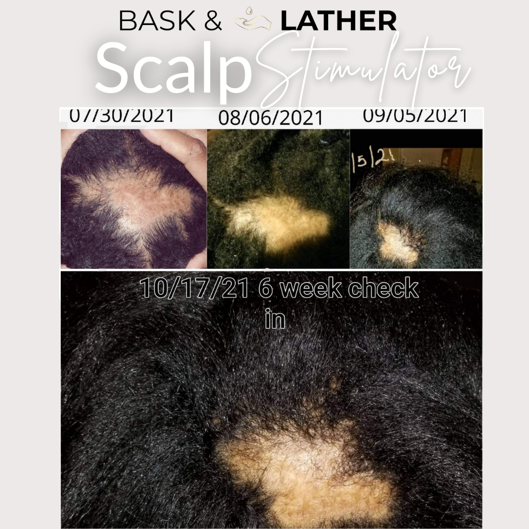 before and after using the scalp stimulator top of the head
