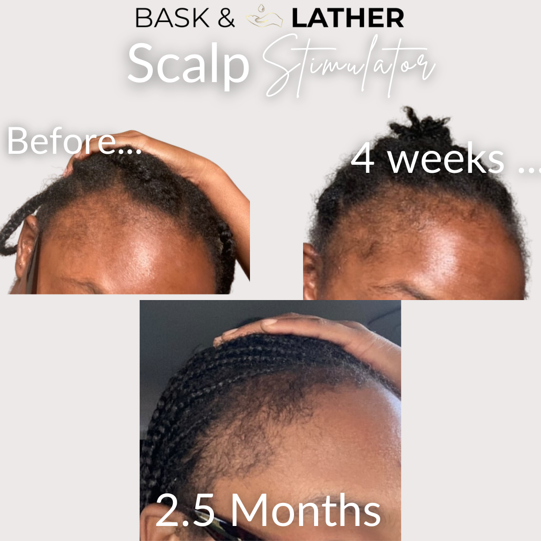 before and after using the scalp stimulator for edges