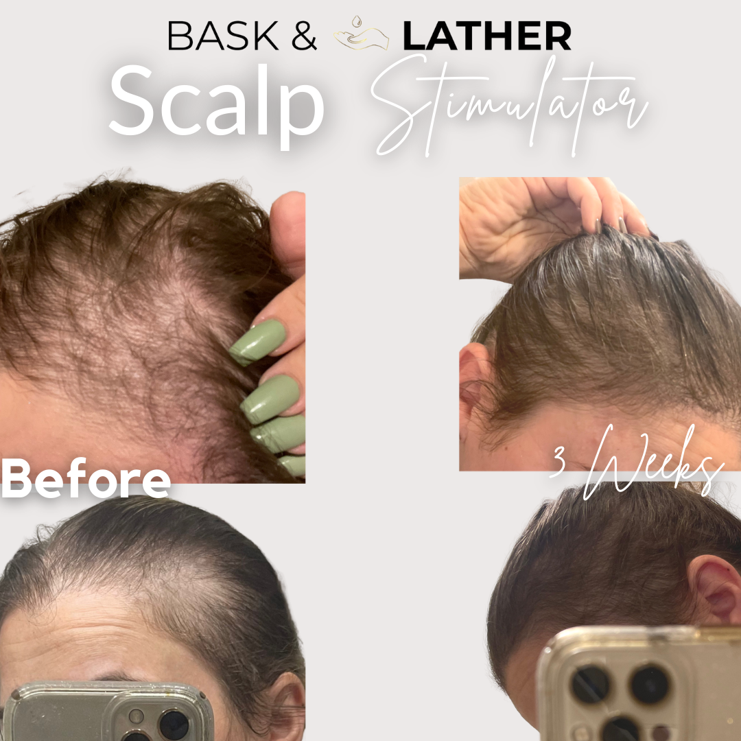 before and after the scalp stimulator - results